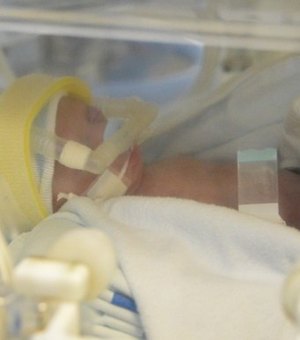 HGE recebe 19 recém-nascidos com suspeitas de microcefalia