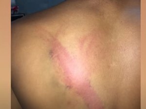 Polícia investiga empresa de segurança privada após garçom ser agredido em festa