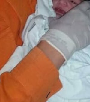 Bebê de 1 ano sobrevive à queda de escada na cidade de União dos Palmares