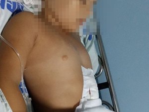 Polícia Civil prende acusado de esfaquear enteada de quatro anos e ex-esposa 