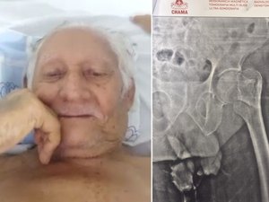 Idoso aguarda há quase 50 dias por cirurgia no colo do fêmur, em Arapiraca, e família aciona a justiça