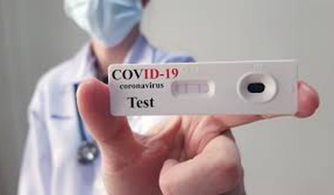 Com mais 1.273 pacientes, AL tem 26.906 casos confirmados de Covid-19
