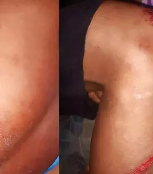 Família acusa Guarda Municipal de espancar jovem em São José da Laje: 'desumano'