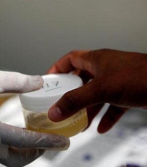 Covid: brasileiros criam teste de urina mais preciso que exame de sangue na detecção de anticorpos