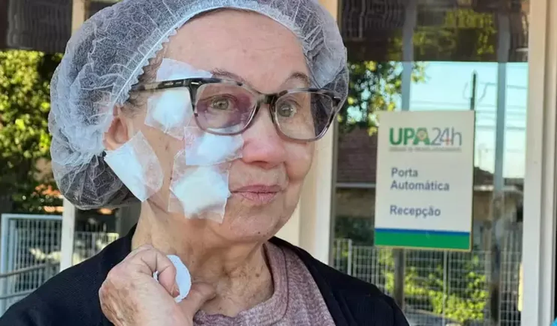 Idosa de 79 anos é atacada por pit bull e leva 50 pontos no rosto no interior de SP