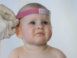 Responsáveis por bebês com microcefalia terão direito a auxílio do INSS