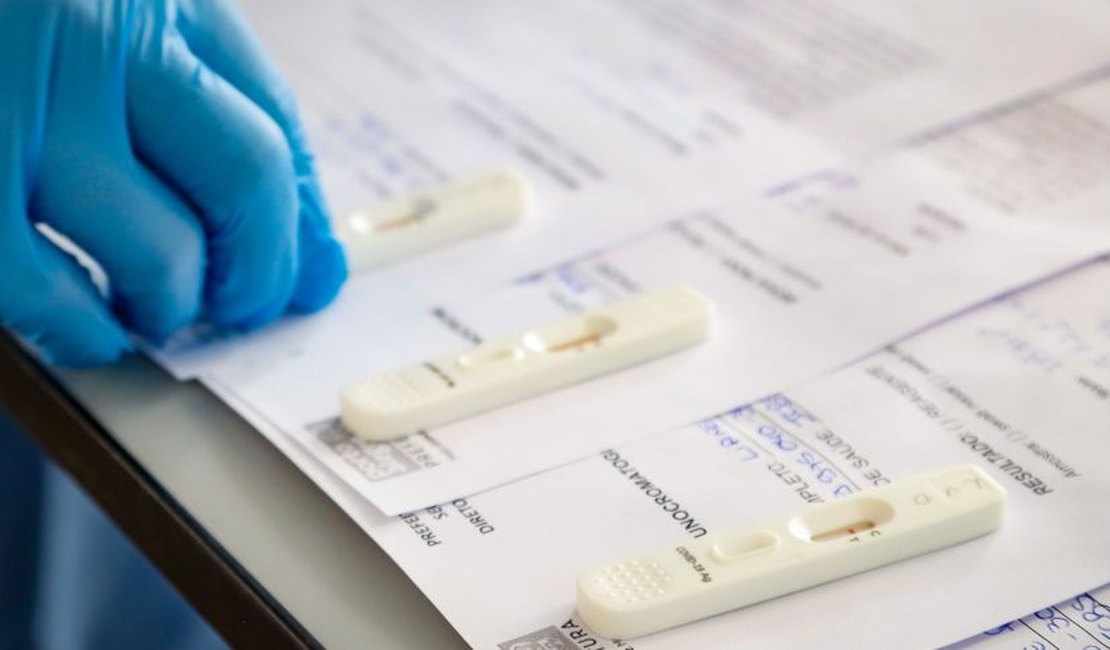 Testes positivos de Covid-19 em farmácias têm queda de quase 40%, diz Abrafarma
