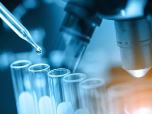 Laboratório japonês testará detecção de câncer com mostras de urina