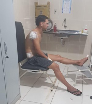 Jovem sofre acidente após passar em buraco na AL-101 Norte em Milagres