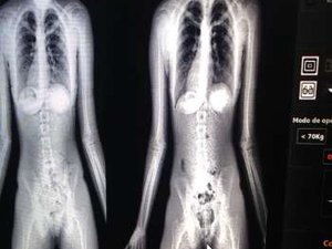 Jovem é presa tentando entrar com drogas no Sistema Prisional