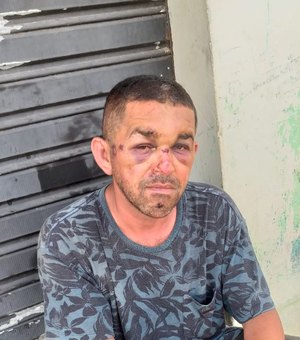 Homem é espancado durante três dias pelo próprio irmão em Palmeira