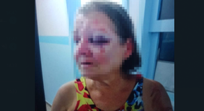 Delegacia de Campo Alegre conclui inquérito de filho que espancou a própria mãe