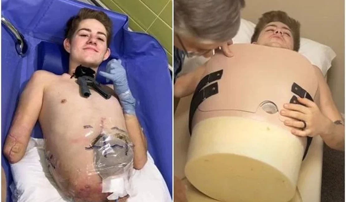 Jovem cortado ao meio pediu a médico para “salvar ao menos a cabeça”