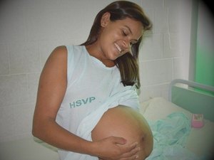 Microcefalia não caracteriza gravidez de alto risco