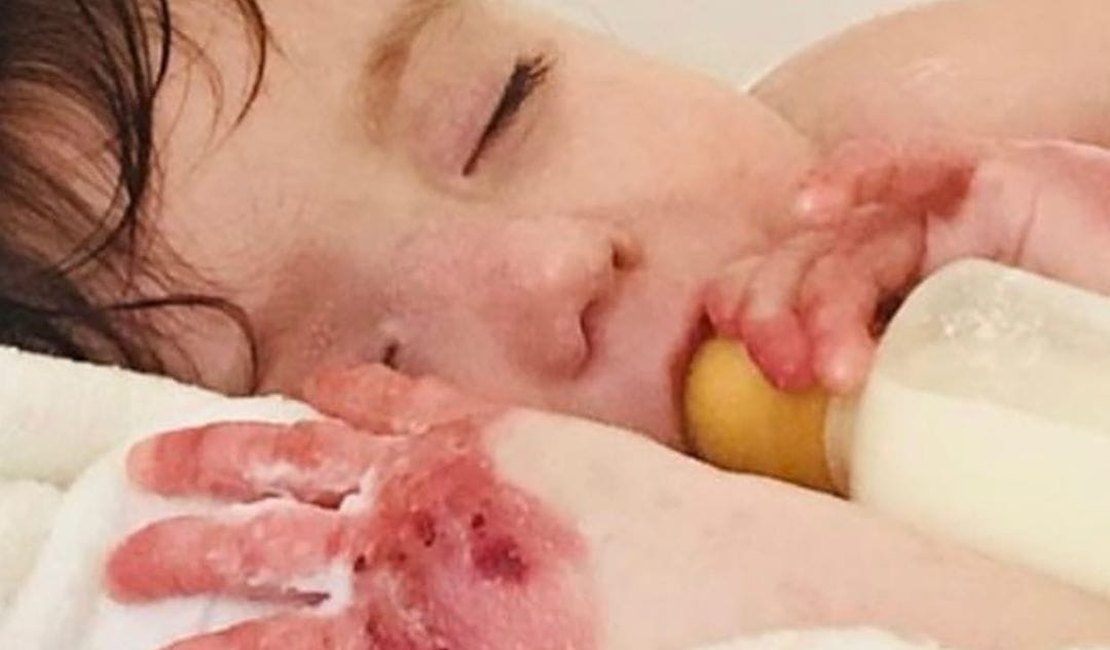 Palestra Beneficente Vai Ajudar Criancas Borboletas 7segundos Arapiraca