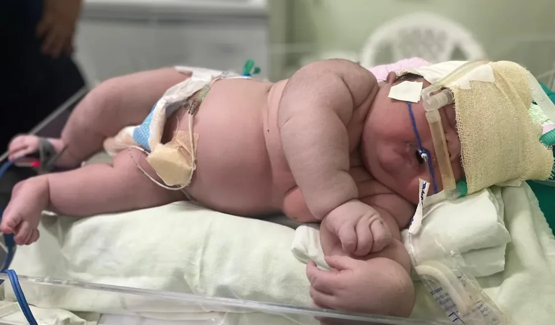 'Bebê Gigante' nasce com mais de 7 kg em maternidade de Parintins, no interior do AM