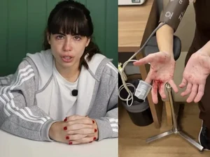 Atriz e influenciadora mostra ferimentos após reagir a assalto em SP