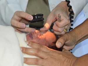 Secretaria de Saúde alerta para cuidados com a visão na infância
