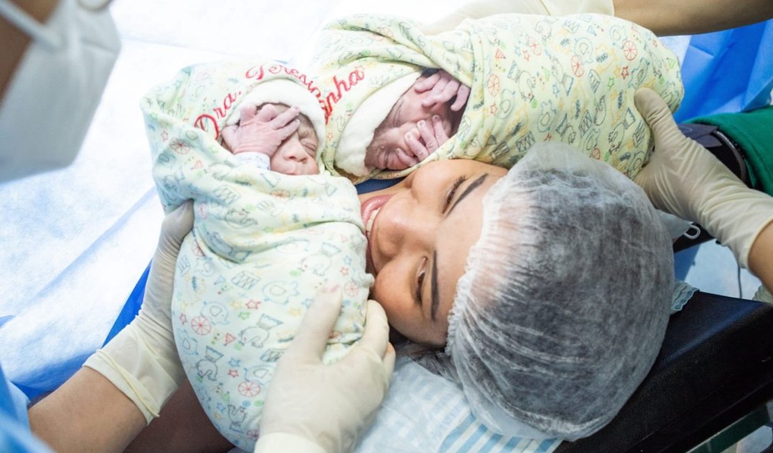Gêmeos nascem empelicados em São Pedro da Aldeia, no RJ