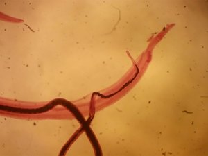 Agentes de Endemias de Arapiraca realizam visitas domiciliares para investigar casos de esquistossomose