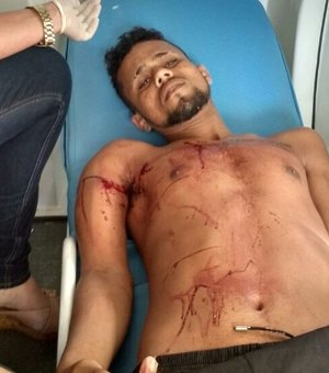 Briga entre rivais termina com duas pessoas gravemente feridas na Região Metropolitana