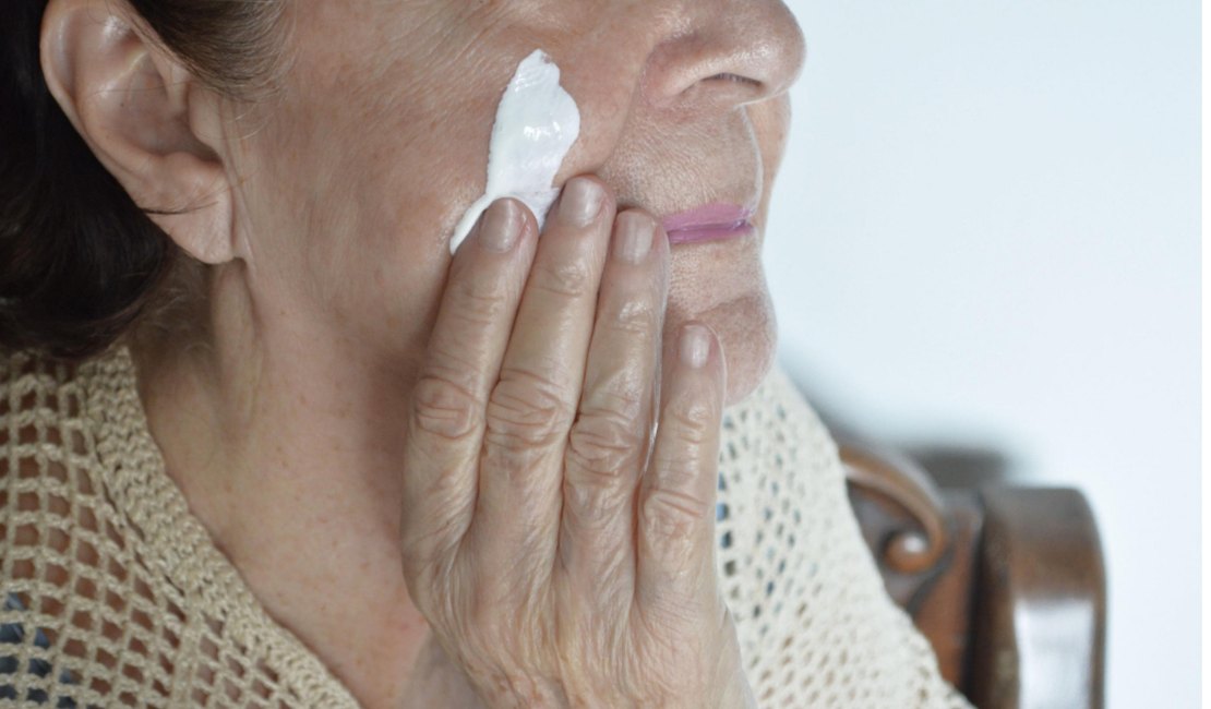 Dermatologista da Sesau orienta sobre os cuidados para evitar o câncer de pele no verão