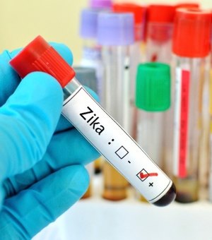 Planos de saúde terão que pagar exames de Zika a partir de hoje