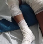 Porto Calvo: Criança é atropelada por adolescente que empinou moto em via pública