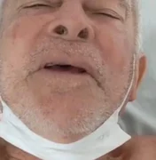 Idoso atropelado em Maragogi aguarda cirurgia após material hospitalar acabar, diz família