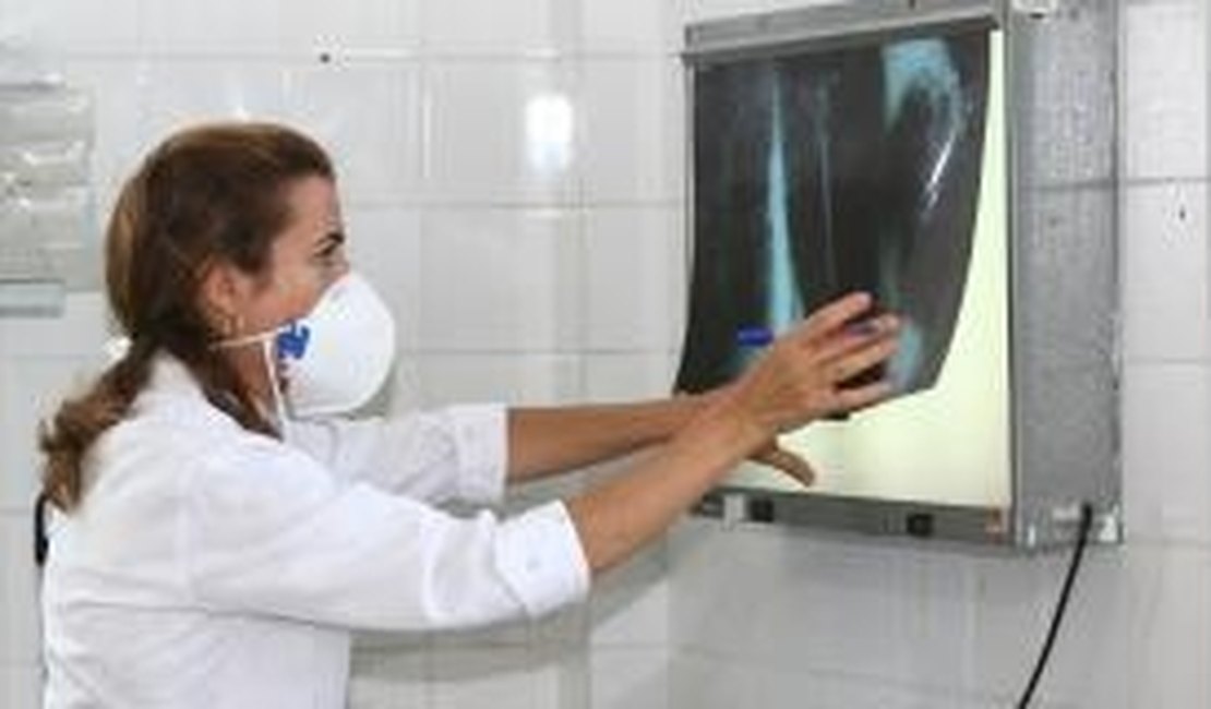 Delmiro Gouveia enfrenta um surto de tuberculose, diz Secretaria Municipal de Saúde