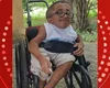Adolescente com 'ossos de vidro' morre, aos 15 anos, em Feira de Santana