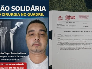 Marceneiro de Arapiraca faz vaquinha para custear cirurgia de R$ 40 mil no quadril