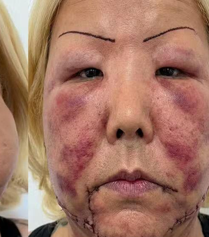 Conheça Juju do Pix, influenciadora que passa por reconstrução facial