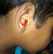 Família pede ajuda para tratamento de criança com doença no ouvido em Arapiraca 