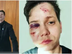 Karol Eller, lésbica apoiadora de Bolsonaro, sofre ataque homofóbico