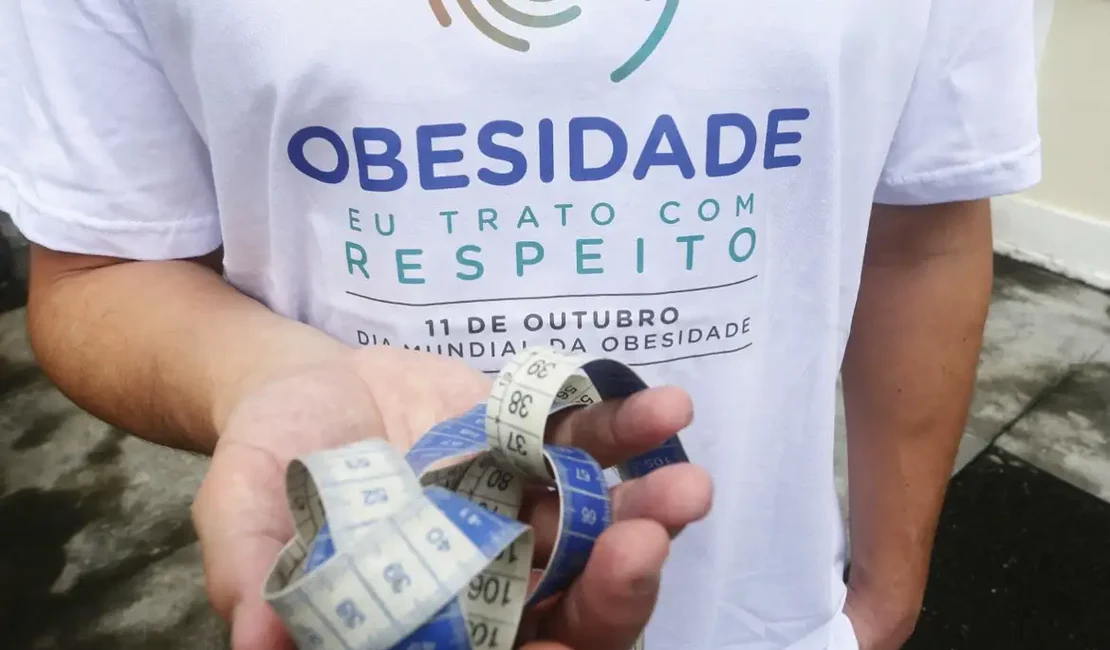 Jovem a partir dos 14 anos passa a poder fazer cirurgia bariátrica
