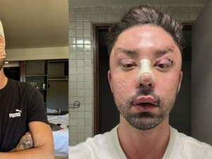 Rico Melquiades se viciou em remédio após onda de críticas: 'Precisava me dopar para dormir'