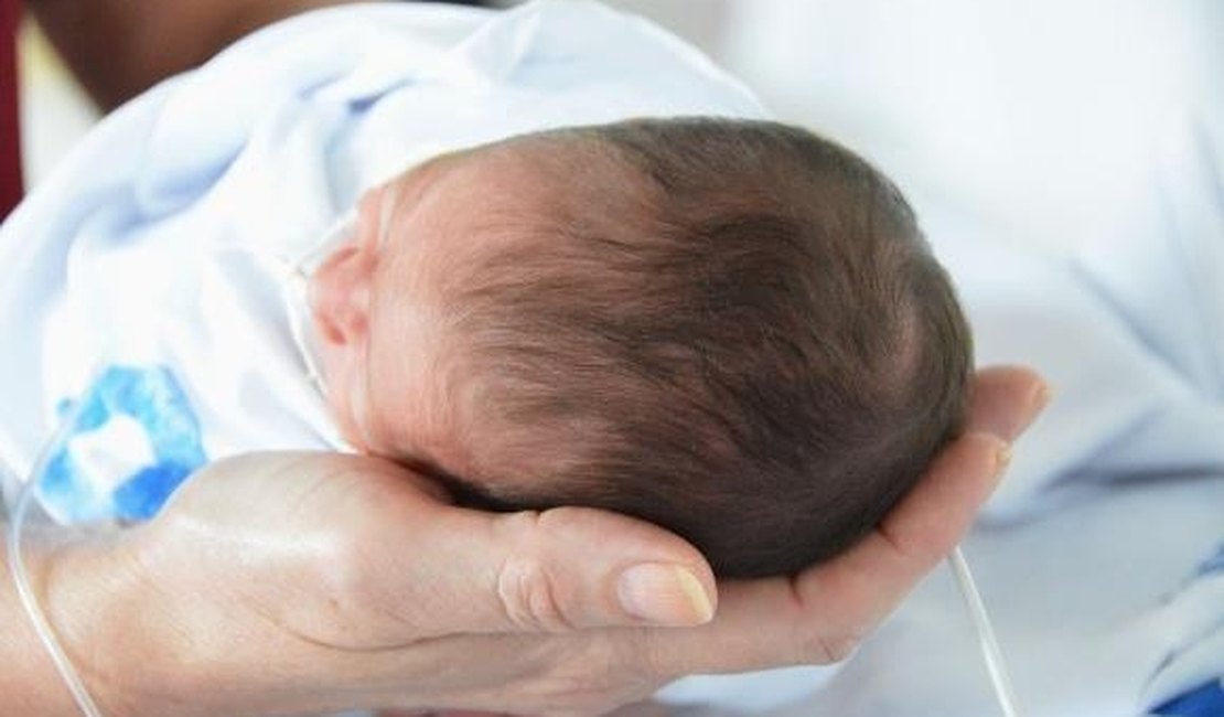 Saúde: Alagoas garante cuidado aos bebês com microcefalia