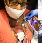 Nascido com 21 semanas, bebê bate recorde de mais novo prematuro a sobreviver