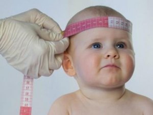 Saúde divulga nota com atualização de casos de microcefalia