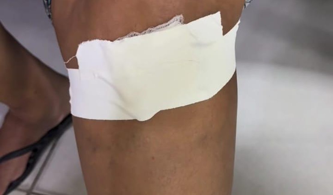 Homem vê assalto, reage e acaba atirando em moradora no Pilar