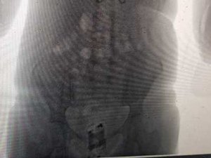 Mulher é presa com celular escondido nas partes íntimas 