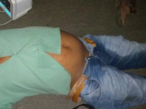 Homem morre em queda de moto no Trevo da Morte em Major Izidoro