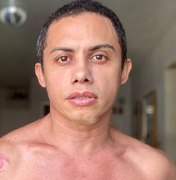 Ator Silvero Pereira revela ter sido estuprado aos 7 anos