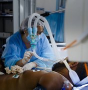 Secretaria garante kits de intubação para pacientes com Covid-19 em Alagoas