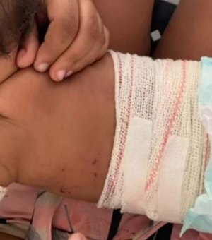 Bebê é atingida por rojão após discussão por uso de máscara em bar