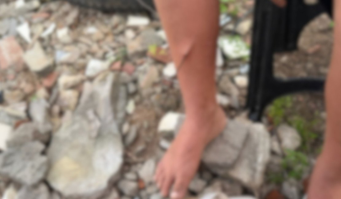 Criança de 10 anos é levada ao HEA após ter perna perfurada por vergalhão em Arapiraca