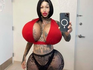 Influencer viciada em plásticas já gastou mais de 514 mil reais em cirurgias