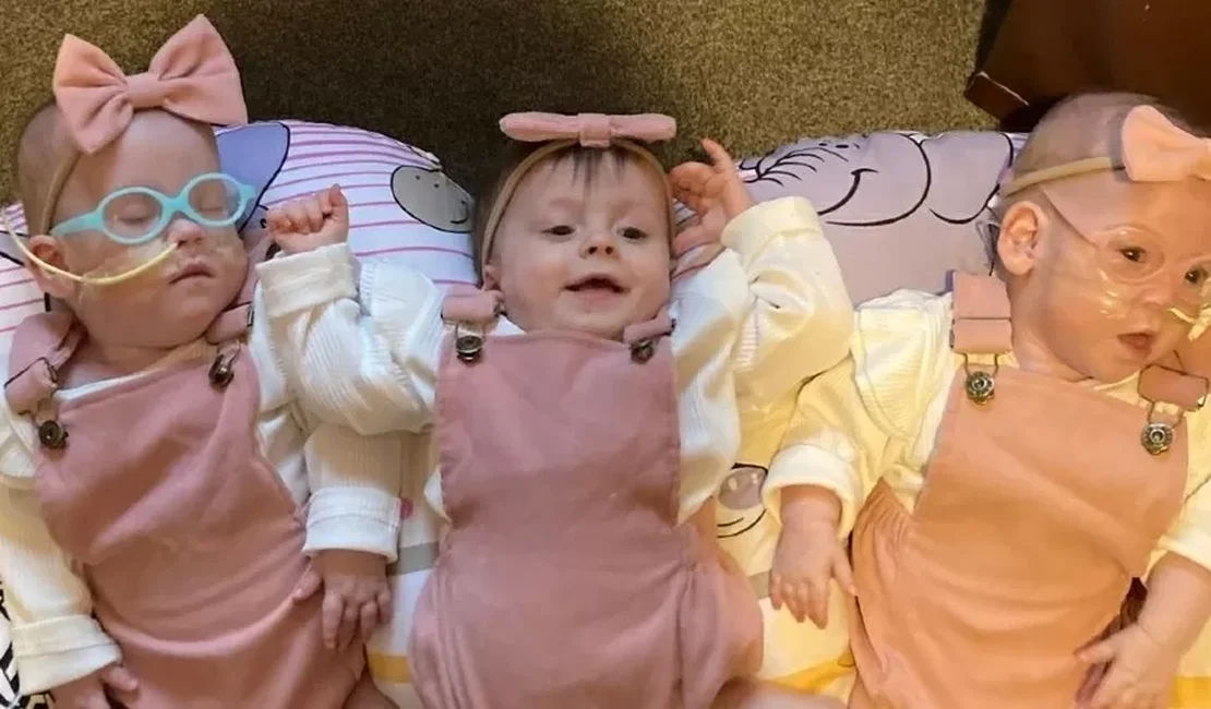 Guinness Book: britânicas se tornam as trigêmeas mais prematuras do mundo