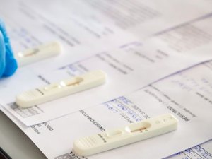 Testes positivos de Covid-19 em farmácias têm queda de quase 40%, diz Abrafarma